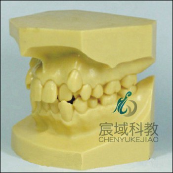 CY-KQ067 错颌畸形分类演示模型A