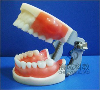 CY-KQ079 医学考试专用脓肿切开和牙体预备模型