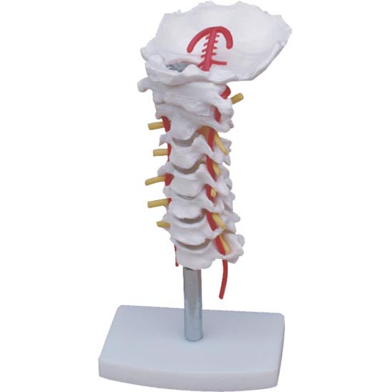 CY-XC133 颈椎带颈动脉、后枕骨、椎间盘与神经模型
