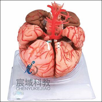 A18220 脑动脉模型