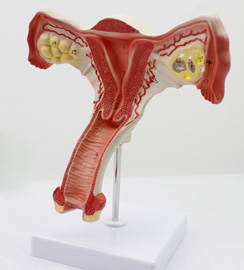 女性内生殖器模型