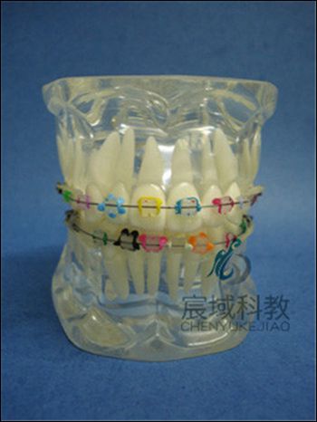 CY-KQ017 综合正畸水晶牙列模型