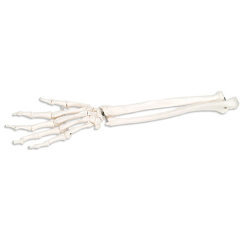 手骨骼(带有部分尺骨和桡骨)灵活移动连接(右)