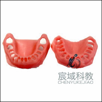 CY-KQ058 软牙龈模型