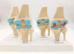 4阶段膝关节模型