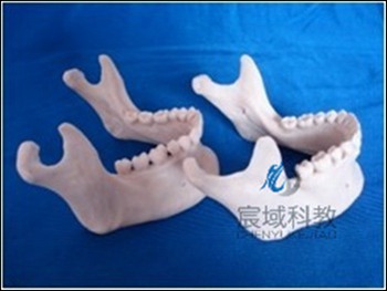 CY-KQ034 仿真下颌骨模型