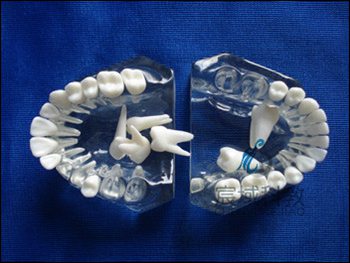 CY-KQ018 标准水晶牙列模型(全口牙可拆)