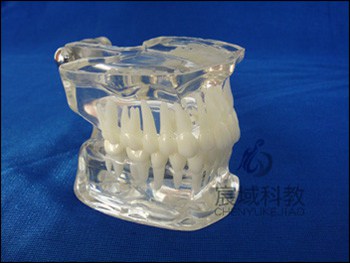CY-KQ019  标准水晶牙列模型(德frassaco颌架)
