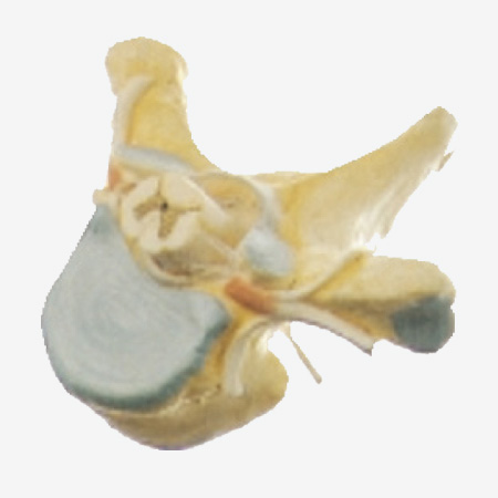 CY-A18106 胸椎附脊髓和脊神经放大模型
