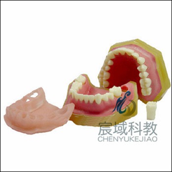 CY-KQ059 标准牙颌模型C